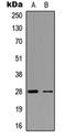 Fibroblast growth factor 23 antibody, orb256535, Biorbyt, Western Blot image 