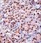 Zinc Finger And BTB Domain Containing 7A antibody, LS-C160728, Lifespan Biosciences, Immunohistochemistry paraffin image 
