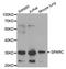 SPARC antibody, A00862, Boster Biological Technology, Western Blot image 