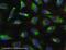 ATP Binding Cassette Subfamily D Member 3 antibody, ab3421, Abcam, Immunocytochemistry image 