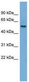Sperm Associated Antigen 6 antibody, TA335366, Origene, Western Blot image 