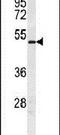 Doublesex And Mab-3 Related Transcription Factor 3 antibody, PA5-24027, Invitrogen Antibodies, Western Blot image 