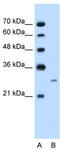 Follistatin antibody, TA346430, Origene, Western Blot image 