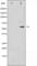 Cell Division Cycle 25A antibody, abx010530, Abbexa, Western Blot image 