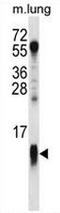 Cytochrome C Oxidase Subunit 7A1 antibody, AP51036PU-N, Origene, Western Blot image 