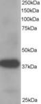 Aldo-Keto Reductase Family 1 Member A1 antibody, LS-B2745, Lifespan Biosciences, Western Blot image 
