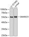 SWI/SNF-related matrix-associated actin-dependent regulator of chromatin subfamily E member 1 antibody, GTX33031, GeneTex, Western Blot image 