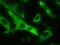 Coagulation Factor VIII antibody, 21485-1-AP, Proteintech Group, Immunofluorescence image 