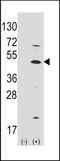 Protein atonal homolog 1 antibody, TA302151, Origene, Western Blot image 