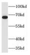 MAPK Associated Protein 1 antibody, FNab04996, FineTest, Western Blot image 