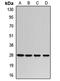 Ribosomal Protein L8 antibody, orb411651, Biorbyt, Western Blot image 