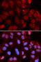 V(D)J recombination-activating protein 2 antibody, LS-C334173, Lifespan Biosciences, Immunofluorescence image 