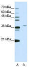 Squamous cell carcinoma antigen recognized by T-cells 3 antibody, TA343750, Origene, Western Blot image 