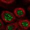 G-Patch Domain Containing 4 antibody, NBP2-55313, Novus Biologicals, Immunocytochemistry image 