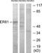 ETV1 antibody, TA313847, Origene, Western Blot image 