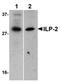 Baculoviral IAP Repeat Containing 8 antibody, SP1413P, Origene, Western Blot image 
