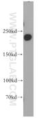 Dedicator of cytokinesis protein 7 antibody, 13000-1-AP, Proteintech Group, Western Blot image 