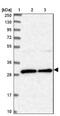 BCDIN3 Domain Containing RNA Methyltransferase antibody, NBP1-85857, Novus Biologicals, Western Blot image 