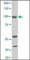 Aldehyde Dehydrogenase 1 Family Member L1 antibody, orb94686, Biorbyt, Western Blot image 