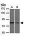 Xenotropic And Polytropic Retrovirus Receptor 1 antibody, orb73942, Biorbyt, Western Blot image 