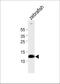 Hemoglobin subunit beta-1 antibody, PA5-72198, Invitrogen Antibodies, Western Blot image 