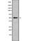 BCL6B Transcription Repressor antibody, abx148578, Abbexa, Western Blot image 