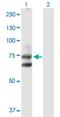 Hedgehog Interacting Protein antibody, H00064399-D01P, Novus Biologicals, Western Blot image 