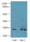 RAB11B, Member RAS Oncogene Family antibody, A60478-100, Epigentek, Western Blot image 