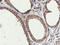 IlvB Acetolactate Synthase Like antibody, TA503079, Origene, Immunohistochemistry paraffin image 