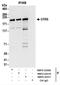 Glutamyl-Prolyl-TRNA Synthetase antibody, NBP2-22311, Novus Biologicals, Immunoprecipitation image 