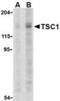 TSC Complex Subunit 1 antibody, TA306217, Origene, Western Blot image 