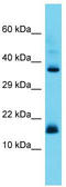 Canopy FGF Signaling Regulator 2 antibody, TA331981, Origene, Western Blot image 