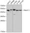 ATXN3 antibody, 14-418, ProSci, Western Blot image 