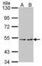 Cytochrome P450 Family 4 Subfamily A Member 11 antibody, TA308529, Origene, Western Blot image 
