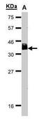 BAF Chromatin Remodeling Complex Subunit BCL7A antibody, PA5-27123, Invitrogen Antibodies, Western Blot image 