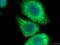 Keratin 20 antibody, 17329-1-AP, Proteintech Group, Immunofluorescence image 