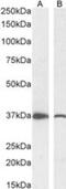 Dimethylarginine Dimethylaminohydrolase 1 antibody, NB300-916, Novus Biologicals, Western Blot image 