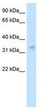 Homeobox protein Hox-A2 antibody, TA329713, Origene, Western Blot image 