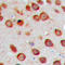 Cytochrome P450 Family 2 Subfamily S Member 1 antibody, LS-C355989, Lifespan Biosciences, Immunohistochemistry paraffin image 