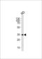 Ectodysplasin-A antibody, MBS9212364, MyBioSource, Western Blot image 