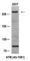 ATM Serine/Threonine Kinase antibody, AP08052PU-N, Origene, Western Blot image 