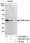 Calcium/Calmodulin Dependent Protein Kinase ID antibody, A302-666A, Bethyl Labs, Immunoprecipitation image 
