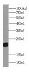 KRAS Proto-Oncogene, GTPase antibody, FNab04644, FineTest, Western Blot image 