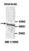 ADAM Metallopeptidase With Thrombospondin Type 1 Motif 3 antibody, orb76989, Biorbyt, Western Blot image 