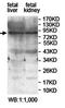 Zinc Finger Protein 606 antibody, orb78190, Biorbyt, Western Blot image 