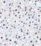 Cell cycle and apoptosis regulator protein 2 antibody, FNab01338, FineTest, Immunohistochemistry paraffin image 