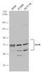 SKI Like Proto-Oncogene antibody, GTX133735, GeneTex, Western Blot image 