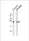 Dual specificity protein phosphatase 22-A antibody, PA5-72645, Invitrogen Antibodies, Western Blot image 