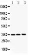 Colony Stimulating Factor 2 antibody, LS-C312621, Lifespan Biosciences, Western Blot image 