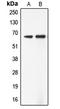 AarF Domain Containing Kinase 5 antibody, LS-C353662, Lifespan Biosciences, Western Blot image 